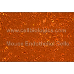 Mouse Induced Pluripotent Stem (iPS) Cells-derived Endothelial Cells