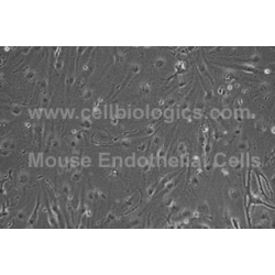 Diabetic Mouse Small Intestinal Microvascular Endothelial Cells