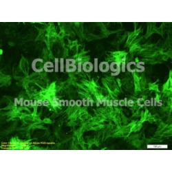 C57BL/6-GFP Mouse Primary Prostate Smooth Muscle Cells