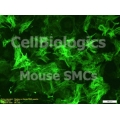 Diabetic Mouse Smooth Muscle Cells